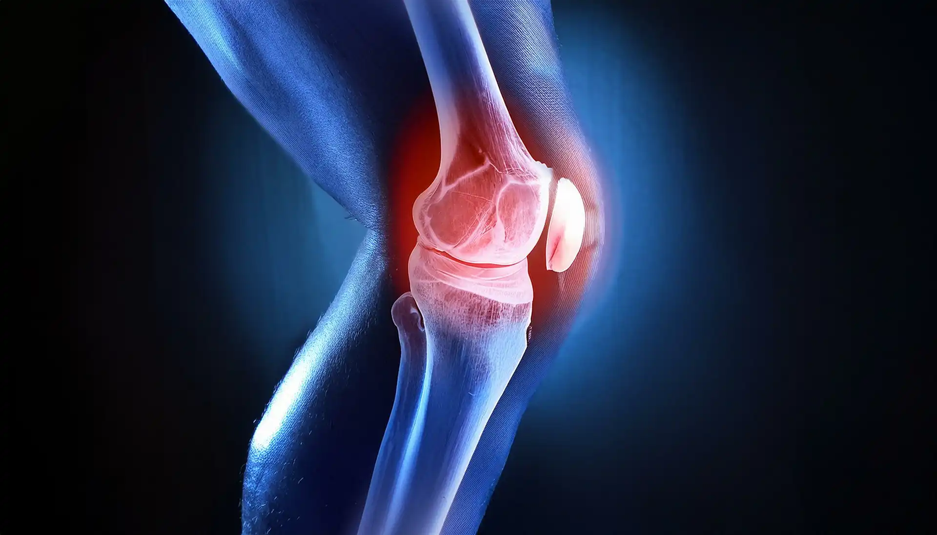 Traditional vs robotic Knee Replacement
