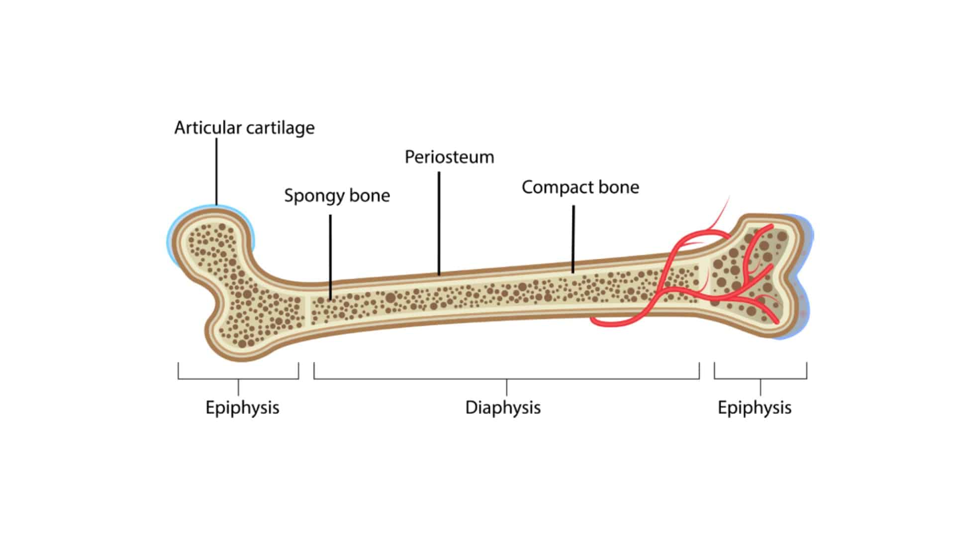 Avascular Necrosis (AVN)