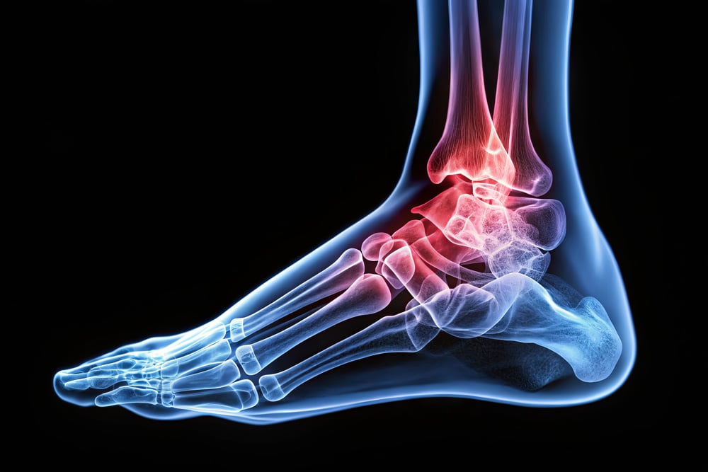 Minimally Invasive Ankle Ligament Reconstruction