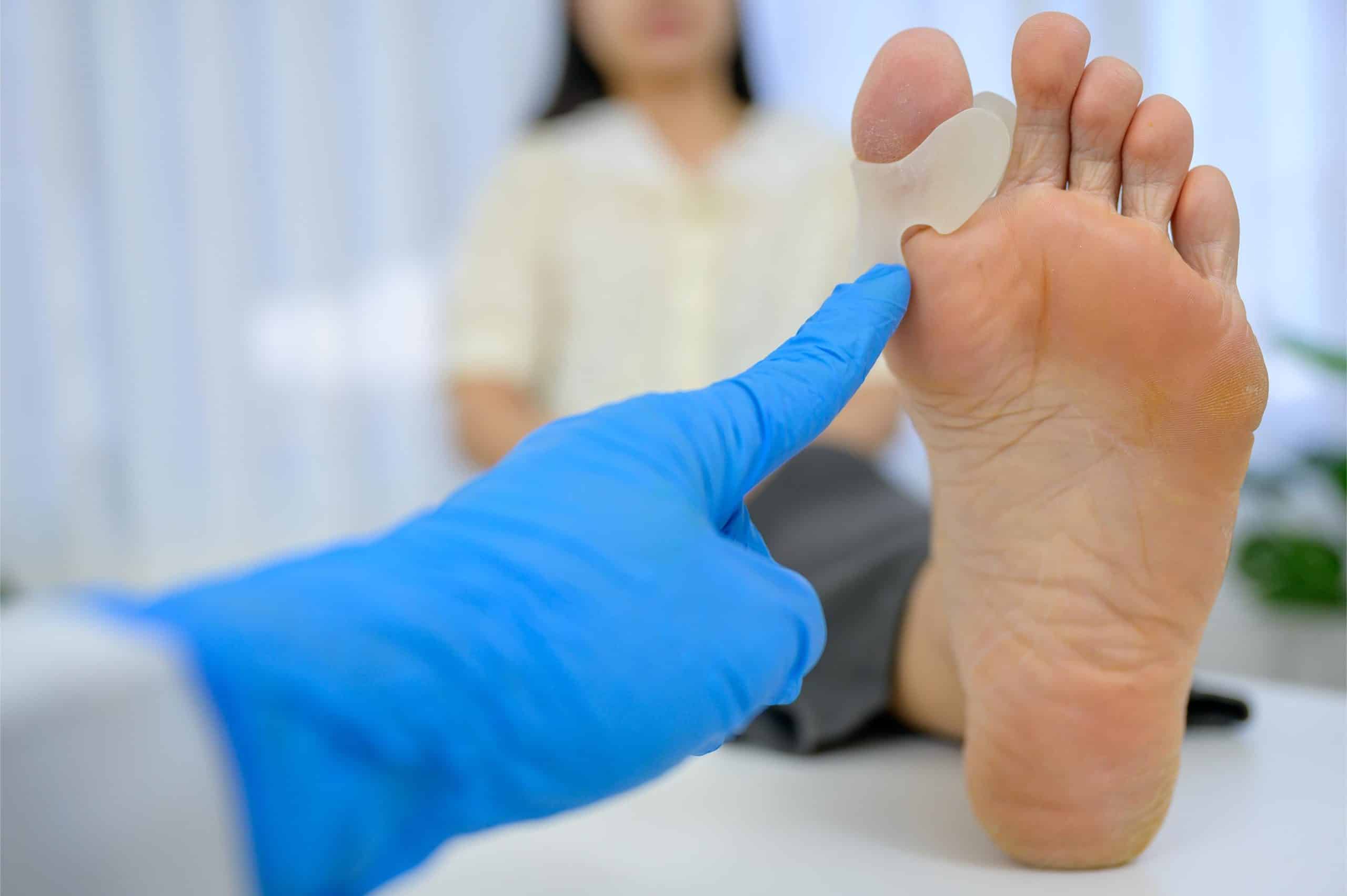 Minimally invasive (MIS) bunion and hammer toe surgery singapore
