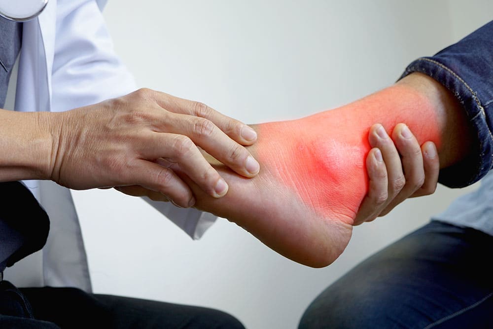 ankle sprain treatment singapore