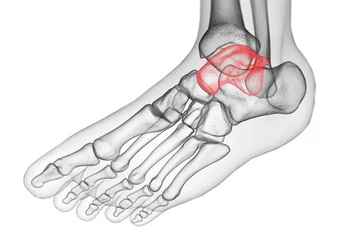 osteochondral injury ankle