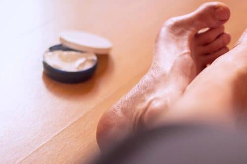 pes cavus high arch foot